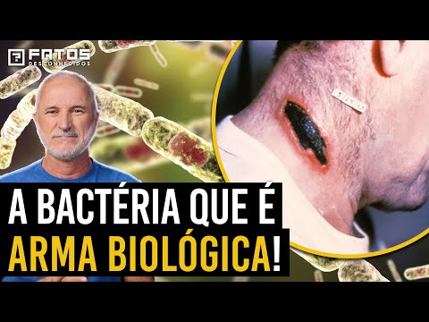 Anthrax: a arma biológica perfeita da natureza